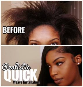 My Leave Out Hair