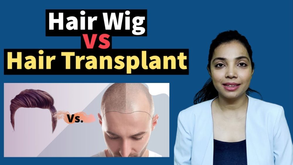 Hair Wigs VS Hair Transplant, Which Is Better Recool Hair